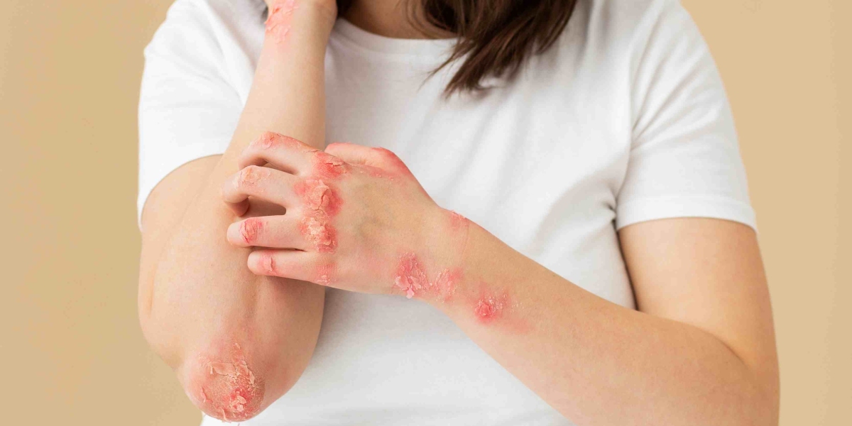 Ivercor 6mg – A Hidden Gem for Immune-Boosting Parasite Defense